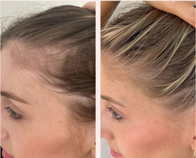 Electric Scalp Massage Comb with Red Light