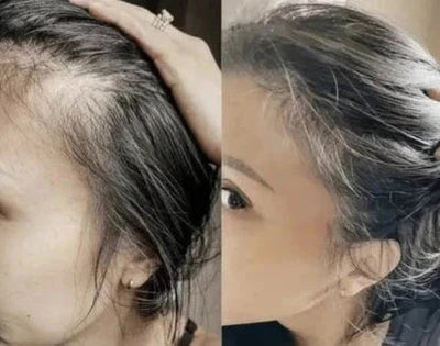 Electric Scalp Massage Comb with Red Light