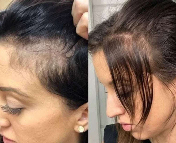 Electric Scalp Massage Comb with Red Light